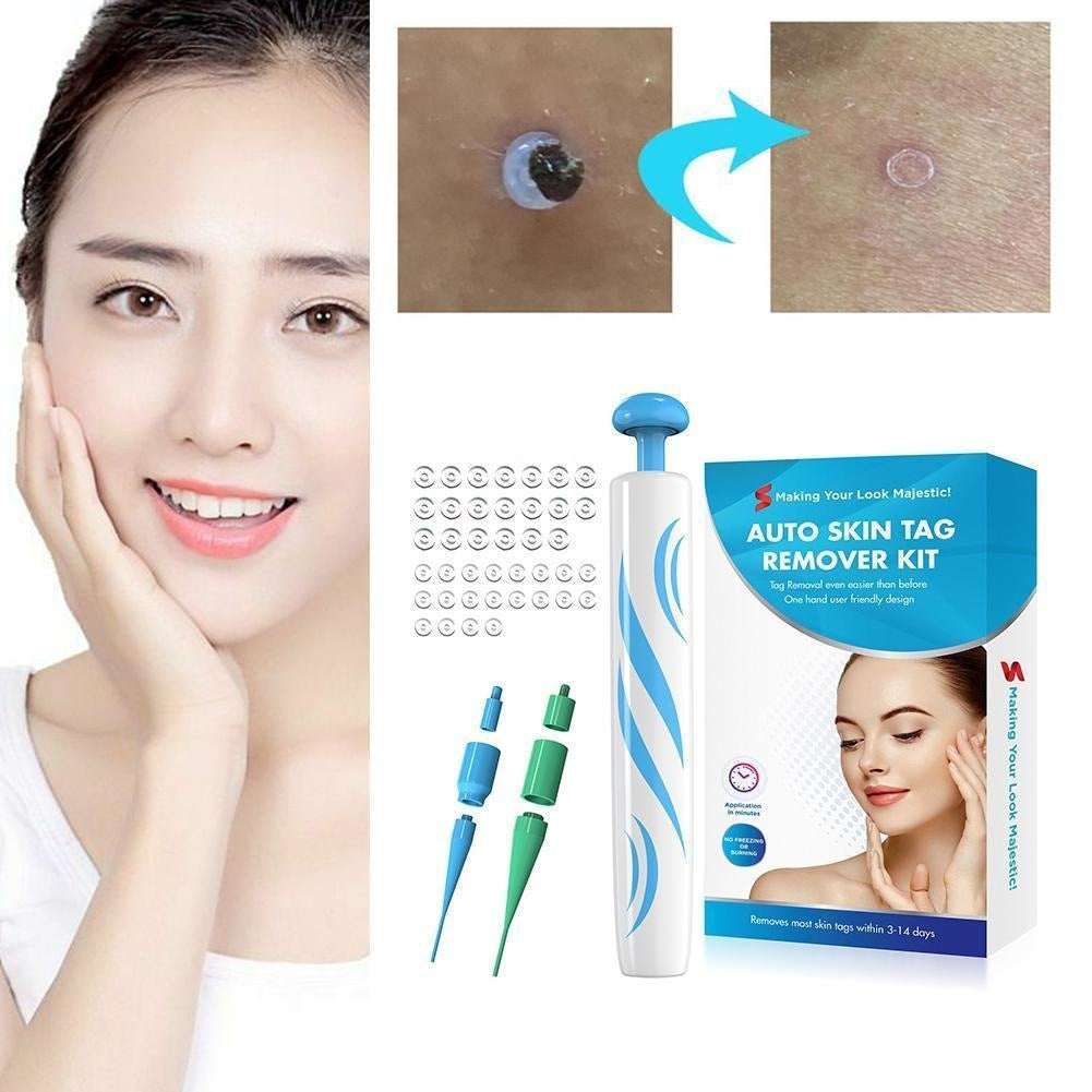 Auto Skin Tag Remover Painless Facial Beauty Tools Mole Wart