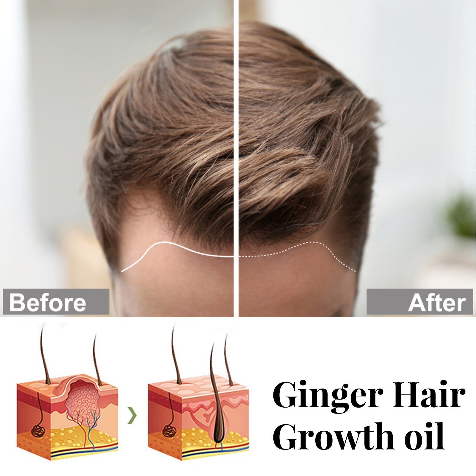 Ginger Repair Hair Follicle Soft Moisturizing And Nourishing Essential Oil